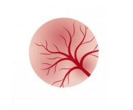 Inflammation of the bladder mucosa and treatment with a femixal capsule